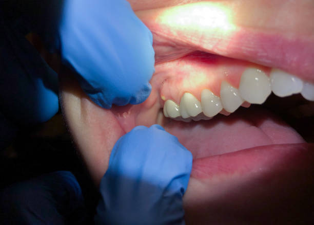 Best Emergency Dental Services for Seniors in Franklinville, NJ